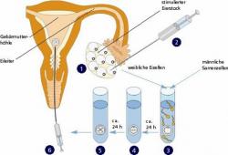 Что такое ivf